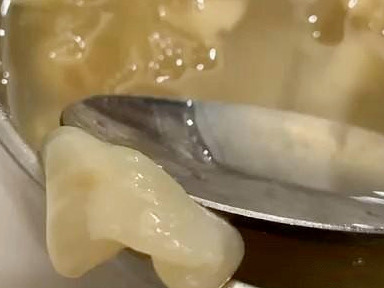 什麼是魚膠？魚膠有什麼營養價值，又有什麼做法呢？